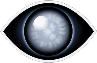 Cataracts