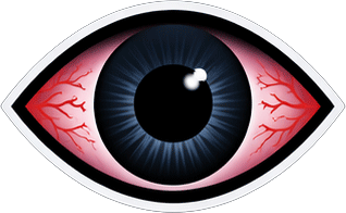 Conjunctivitis