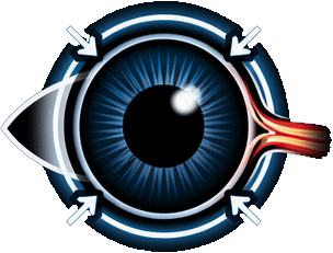 Glaucoma